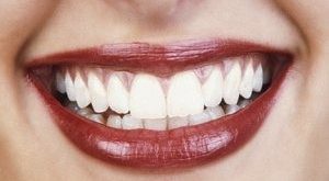 عاداتی که باعث خرابی دندان می شوند