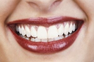 عاداتی که باعث خرابی دندان می شوند
