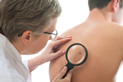 skin canser - مقاله درباره سرطان پوست