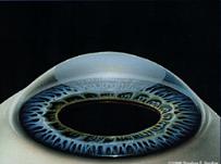 cornea - ساختمان چشم انسان