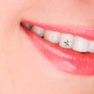 دندان - اطلاعاتی درباره نگین دندان