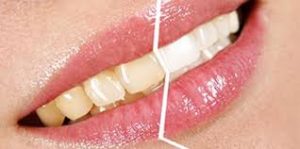 download 14 300x149 - دندانهای براق داشته باشیم