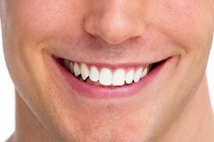 6 روش سفید کردن رنگ دندان در فتوشاپ 310x205 - آموزش سفید کردن دندان در فتوشاپ