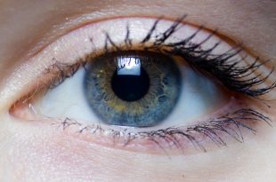 Iris   right eye of a girl 310x205 - التهاب کالامیدیایی