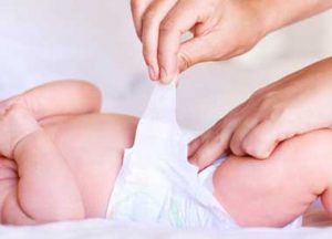 ba2930 1 300x216 - سوختگی ناشی از پوشک نوزادان