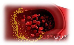 hhh1358 blood fat 300x186 - پیشگیری از چربی خون