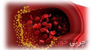 hhh1358 blood fat 310x165 - پیشگیری از چربی خون